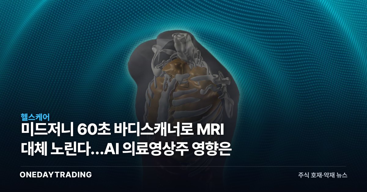 미드저니 60초 바디스캐너로 MRI 대체 노린다…AI 의료영상株 영향은