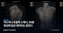 미드저니 초음파 스캐너, 20분 영상에 임상 데이터는 없었다