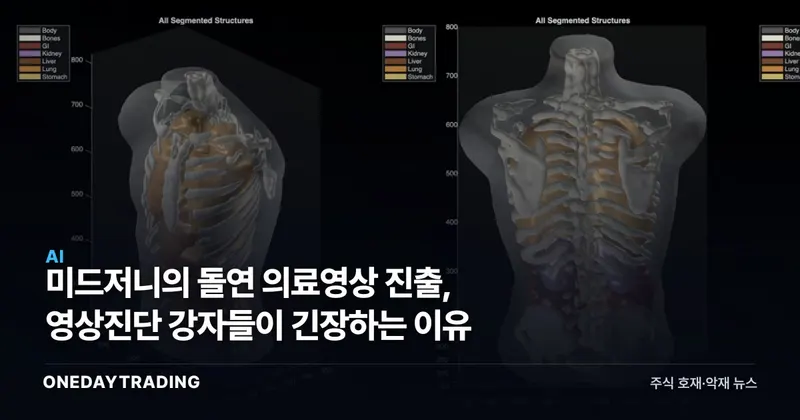 미드저니의 돌연 의료영상 진출, 영상진단 강자들이 긴장하는 이유