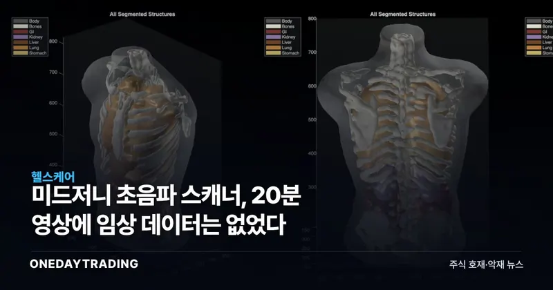 미드저니 초음파 스캐너, 20분 영상에 임상 데이터는 없었다
