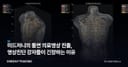 미드저니의 돌연 의료영상 진출, 영상진단 강자들이 긴장하는 이유