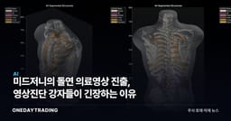 미드저니의 돌연 의료영상 진출, 영상진단 강자들이 긴장하는 이유