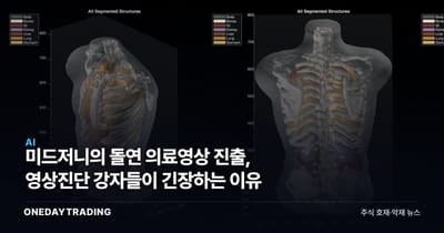 미드저니의 돌연 의료영상 진출, 영상진단 강자들이 긴장하는 이유
