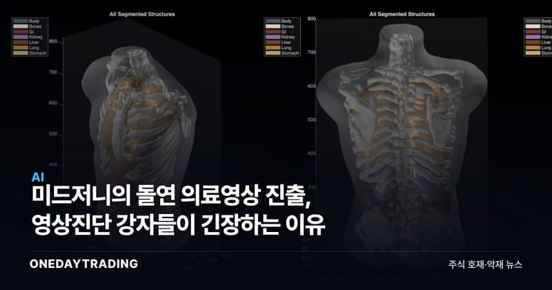 미드저니의 돌연 의료영상 진출, 영상진단 강자들이 긴장하는 이유