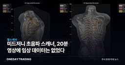 미드저니 초음파 스캐너, 20분 영상에 임상 데이터는 없었다