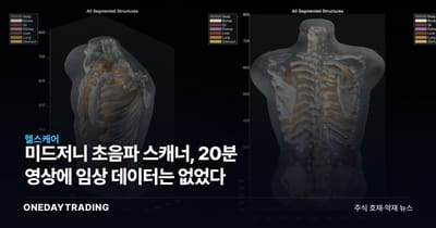 미드저니 초음파 스캐너, 20분 영상에 임상 데이터는 없었다