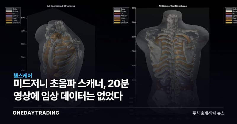 미드저니 초음파 스캐너, 20분 영상에 임상 데이터는 없었다