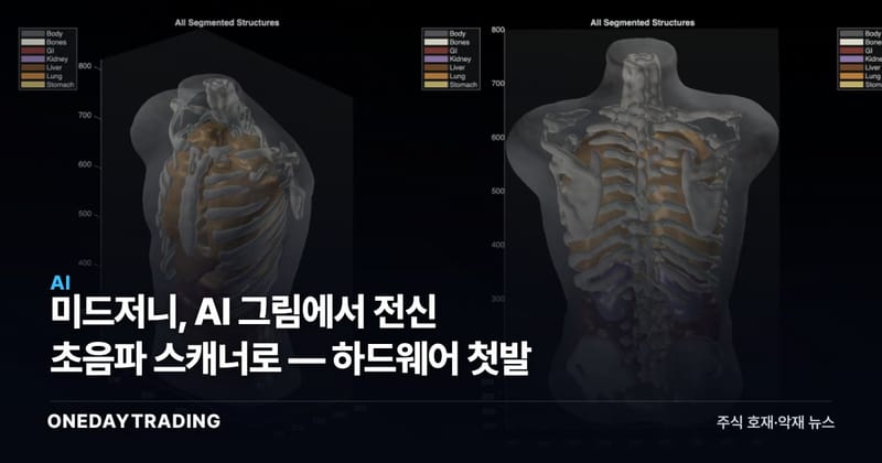 미드저니, AI 그림에서 전신 초음파 스캐너로 — 하드웨어 첫발
