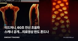 미드저니, 60초 전신 초음파 스캐너 공개…의료영상 판도 흔드나