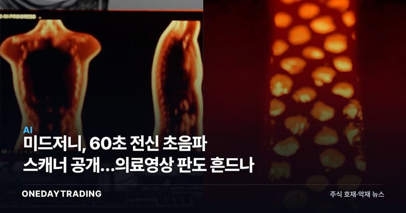 미드저니, 60초 전신 초음파 스캐너 공개…의료영상 판도 흔드나