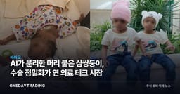 AI가 분리한 머리 붙은 샴쌍둥이, 수술 정밀화가 연 의료 테크 시장