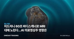 미드저니 60초 바디스캐너로 MRI 대체 노린다…AI 의료영상株 영향은